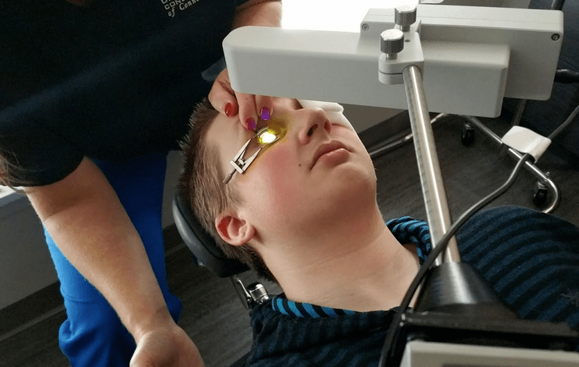 The crossing effectively eliminates keratoconus at the beginning of its development